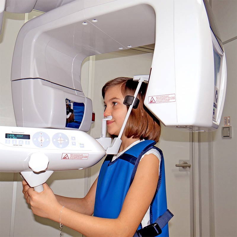 tomografia głowy